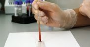 analisi del sangue