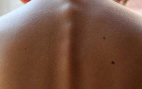 schiena, bambino