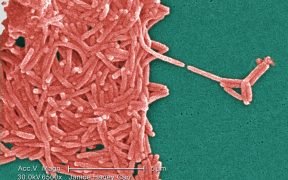 legionella