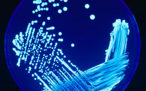 legionella