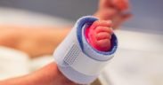 neonato terapia intensiva