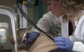 anna abate radiologia senologica, breast unit del san gerardo