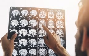 radiografia cervello medico