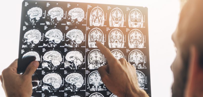 radiografia cervello medico