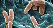 Pseudomonas aeruginosa