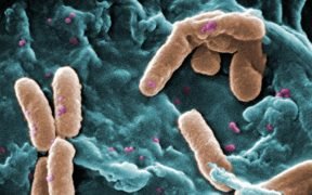 Pseudomonas aeruginosa